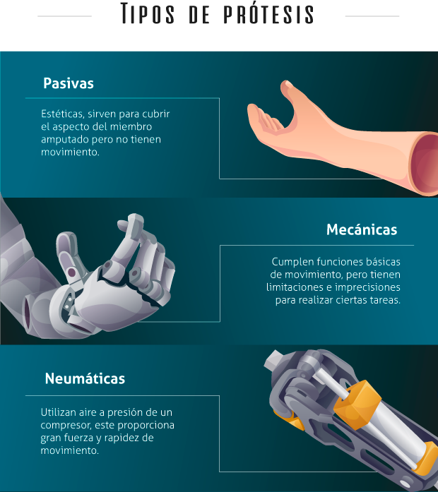 Resultado de imagen para tipos de protesis para el cuerpo humano